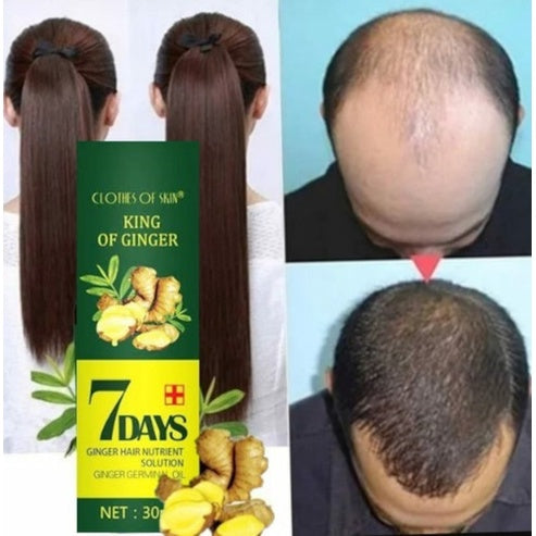 🚨Gran lanzamiento⚡️ Paga 1 Lleva 2 - Serum Jengibre Anti Caída y Crecimiento acelerado 7days™
